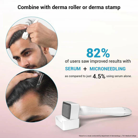 Sotrue Hair Growth Serum With Redensyl 3%, Procapil 3%, Anagain 4% and Baicapil 2% Hair Growth Actives - 30 ml