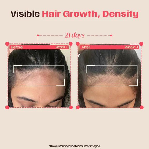 Days Ahead Leave-in Hair Growth Ampoule Serum (Roll on) - 25 ml