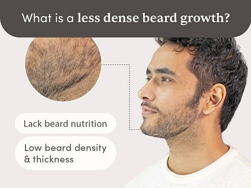 Man Matters Beardmax Growth Serum, Minoxidil 5% - 30 ml
