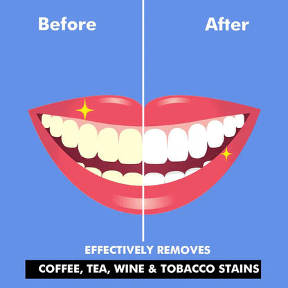 Perfora Teeth Whitening Powder - 50 gm