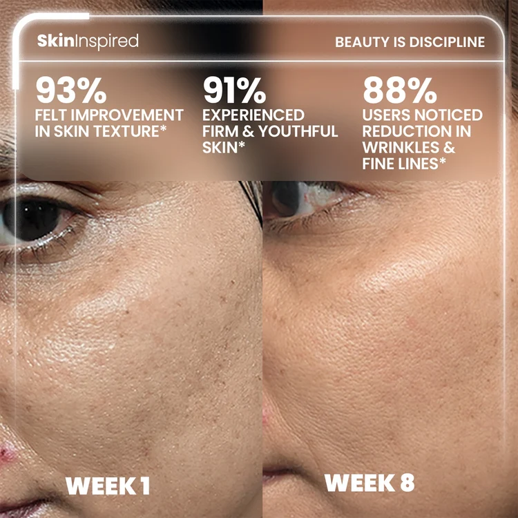 0.1% Retinol Night Cream (50g) | For Anti-Aging & Wrinkle Protection