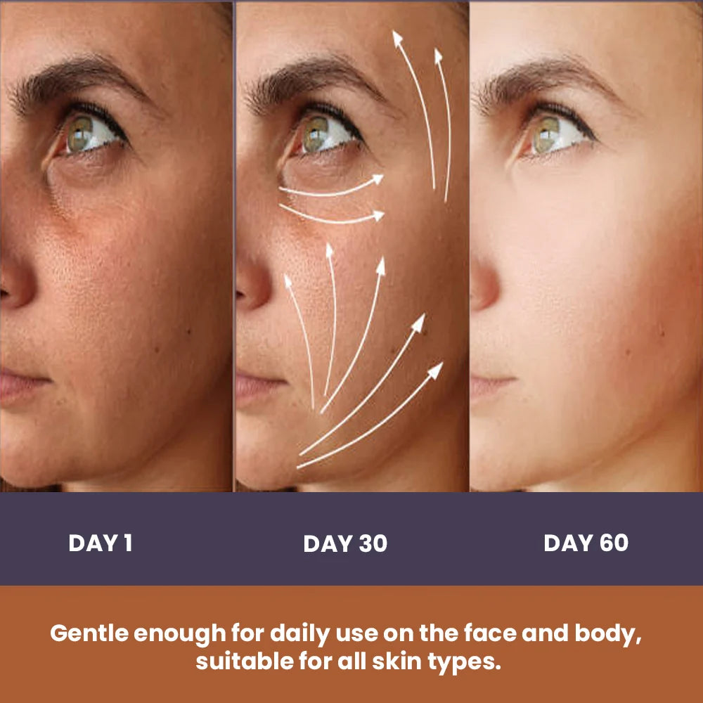 Kojic Acid++