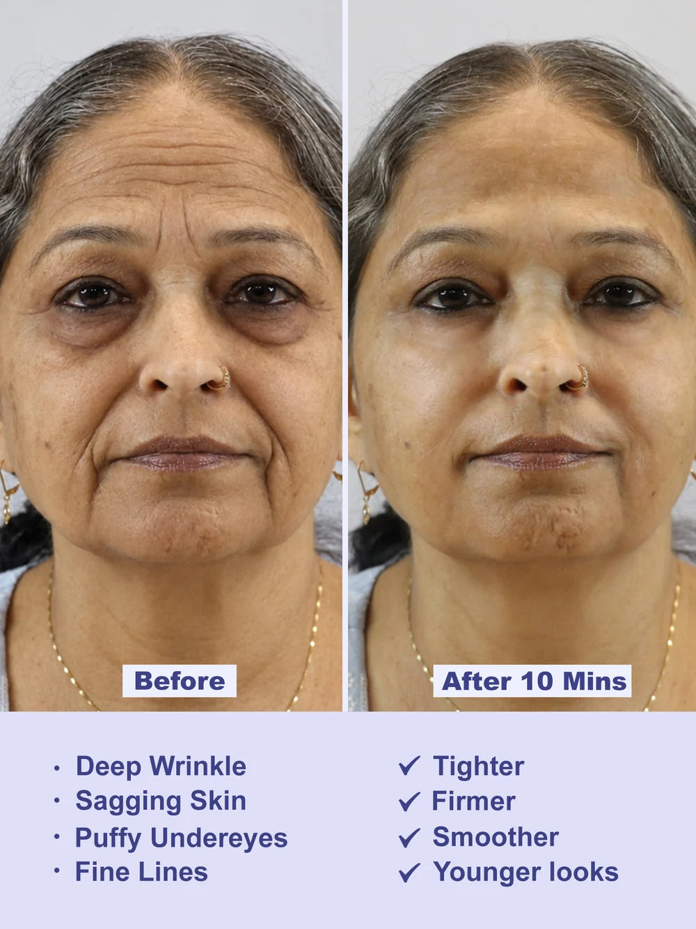Instant Wrinkle Eraser Face Tightener
