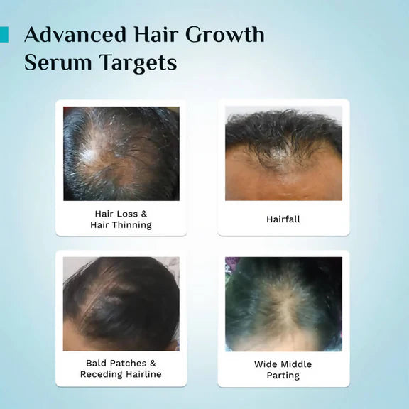 Pilgrim 3% Redensyl, 4% Anagain & 5% Capilia Stem Cell Complex Advanced Hair Growth Serum Roll-On - 25 ml