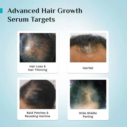 Pilgrim 3% Redensyl, 4% Anagain & 5% Capilia Stem Cell Complex Advanced Hair Growth Serum Roll-On - 25 ml