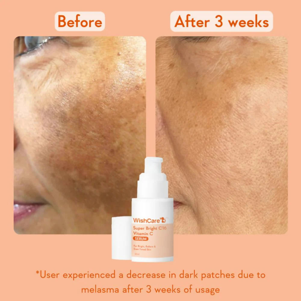 Wishcare Super Bright C16 Vitamin C Face Serum - 30 ml
