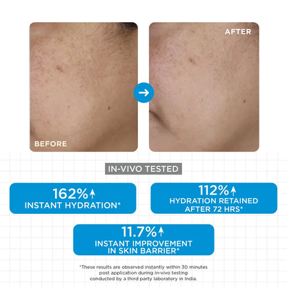 Moisture Balm
