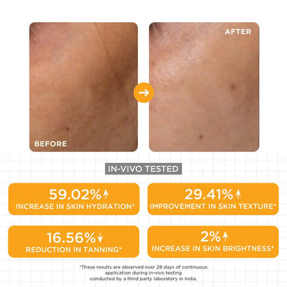 15% Vitamin C Glow Serum