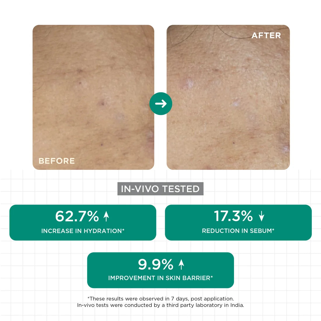 Acne Clear Moisturizer