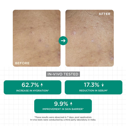 Acne Clear Moisturizer