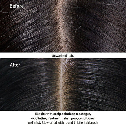 Aveda Scalp Solutions Overnight Scalp Renewal Hair Serum - 50 ml