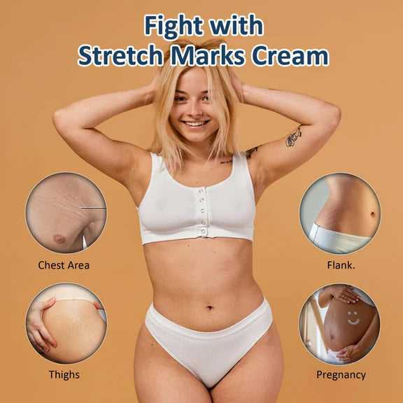 7 Days Natural Stretch Marks Scar Removal Cream Oil - 100 gm