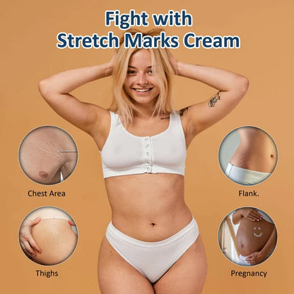 7 Days Natural Stretch Marks Scar Removal Cream Oil - 100 gm
