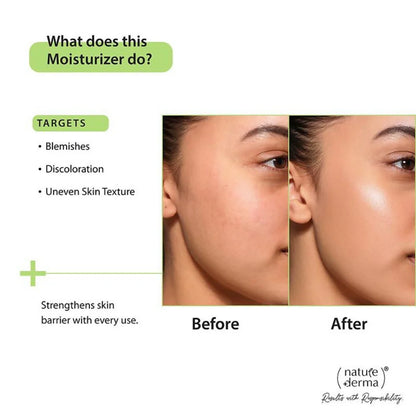Nature Derma 1% Natural Biome-Boost Moisturizer With CICA - 50 ml