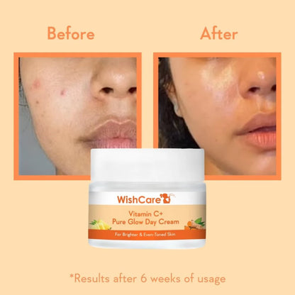 Wishcare Vitamin C+ Pure Glow Face Cream - 50 gm