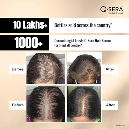 QSERA Hair Serum for Hair Fall Control - 60 ml