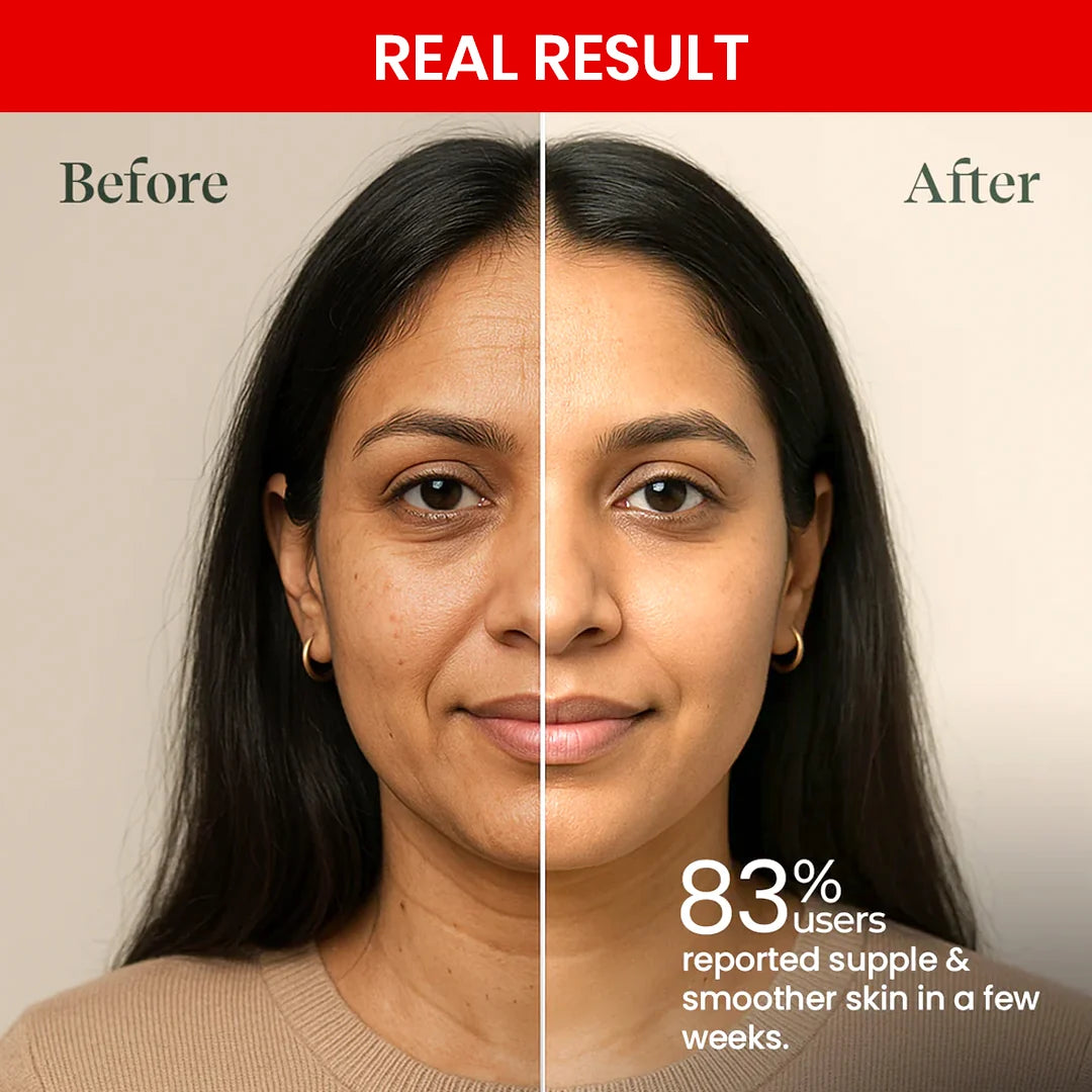 Retinol Pro Night Cream 0.1%