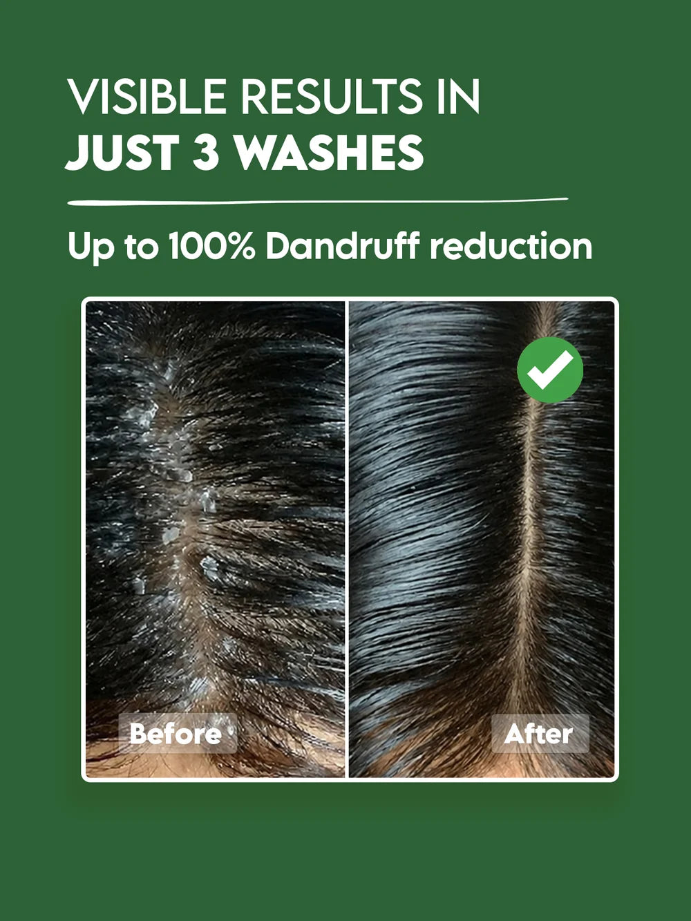 Clensta Anti-Dandruff Shampoo + Conditioner | Flake & Itch Control Hair Care