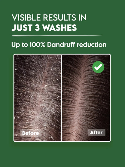 Clensta Anti-Dandruff Hair Serum