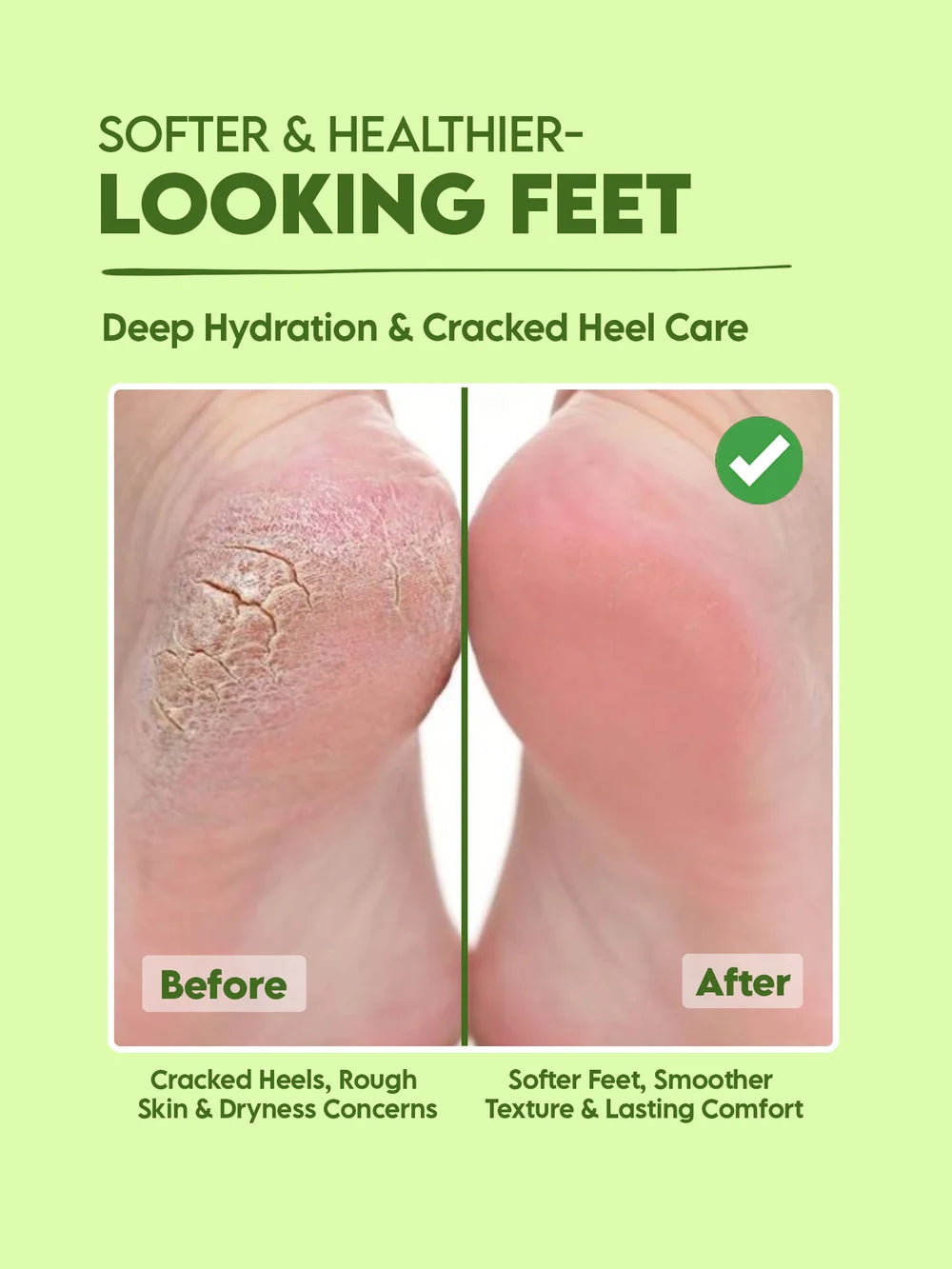 Foot Roll-On 25% Urea Repair