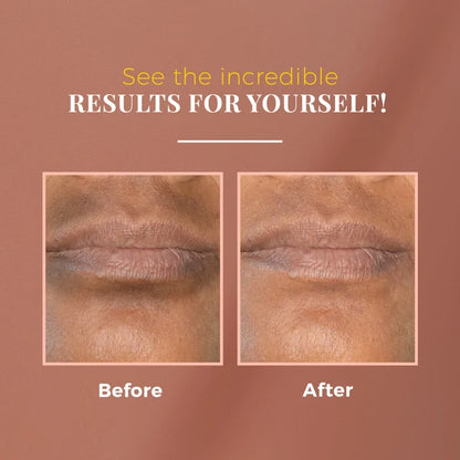 Anti-Pigmentation Kit - Nutmeg & Arjuna Bark for Uneven Skin Tone