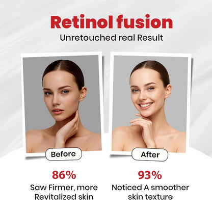 Retinol Fusion Cream 0.05%