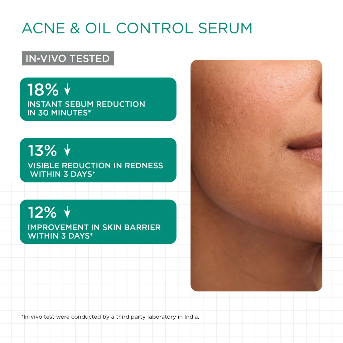 Acne Control & Protect Kit