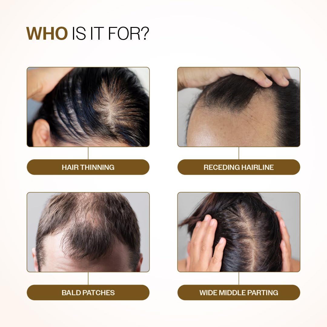 Bare Anatomy Advanced Hair Growth Serum Roll-On with Redensyl, Rosemary & Rice Water