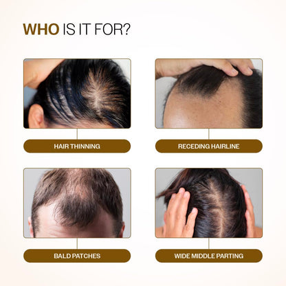 Bare Anatomy Advanced Hair Growth Serum Roll-On with Redensyl, Rosemary & Rice Water