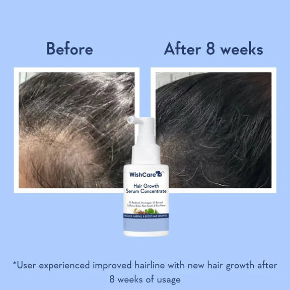 Wishcare Hair Growth Serum Concentrate With 3% Redensyl, 4% Anagain, Rice Water, Biotin - Pack of 1 - 100 ml