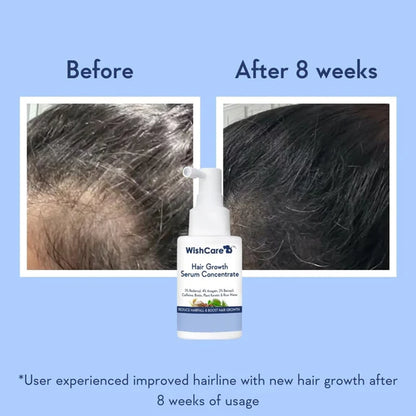 Wishcare Hair Growth Serum Concentrate With 3% Redensyl, 4% Anagain, Rice Water, Biotin - Pack of 1 - 100 ml