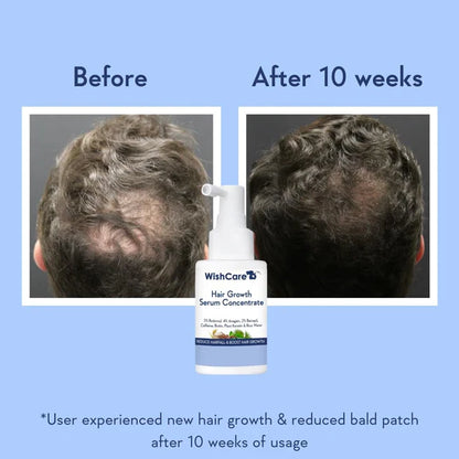 Wishcare Hair Growth Serum Concentrate With 3% Redensyl, 4% Anagain, Rice Water, Biotin - Pack of 1 - 100 ml