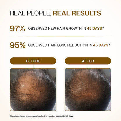 Bare Anatomy Advanced Hair Growth Serum Roll-On with Redensyl, Rosemary & Rice Water