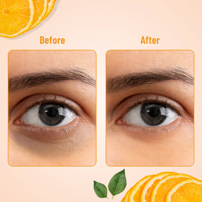 Swiss Beauty Hydra Eye Serum Patches For Dark Circles And Puffiness , Hydrate Skin - Vitamin-C - 60 Patches