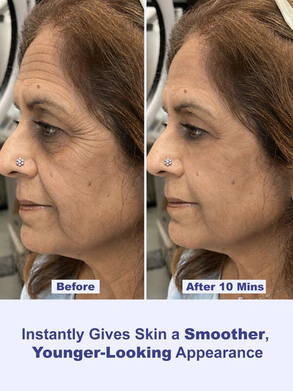 Instant Wrinkle Eraser Face Tightener