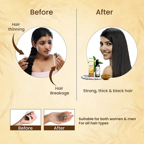 The Skin Story 100% Natural Ayurvedic Hair Oil For Hair Growth - 100 ml
