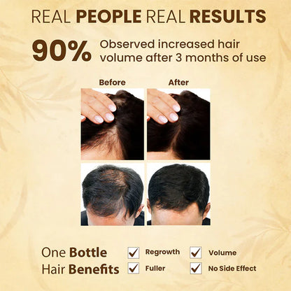 The Skin Story 100% Natural Ayurvedic Hair Oil For Hair Growth - 100 ml