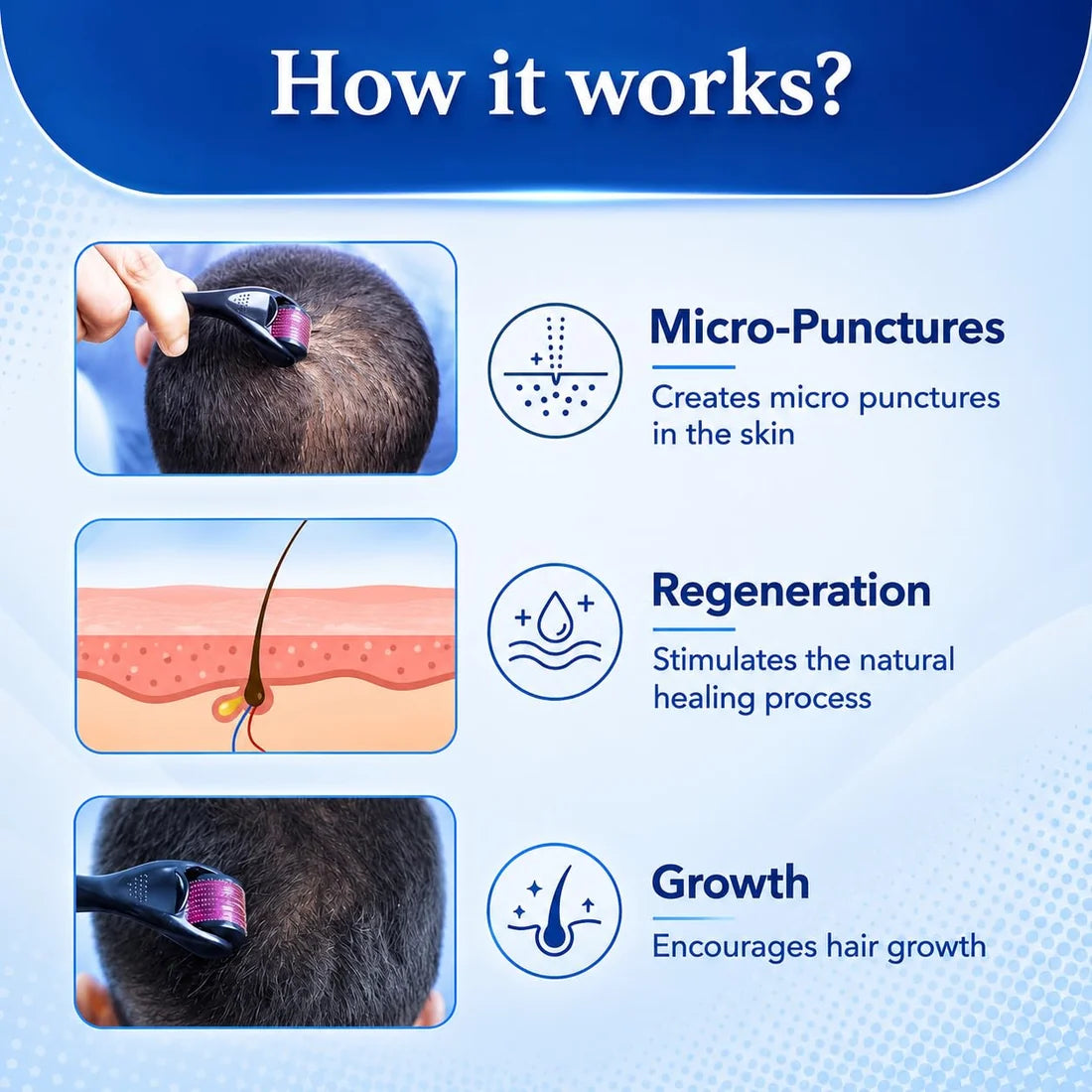 Derma Roller