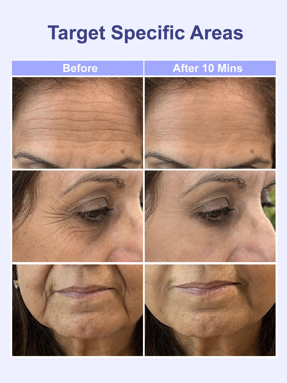 Instant Wrinkle Eraser Face Tightener