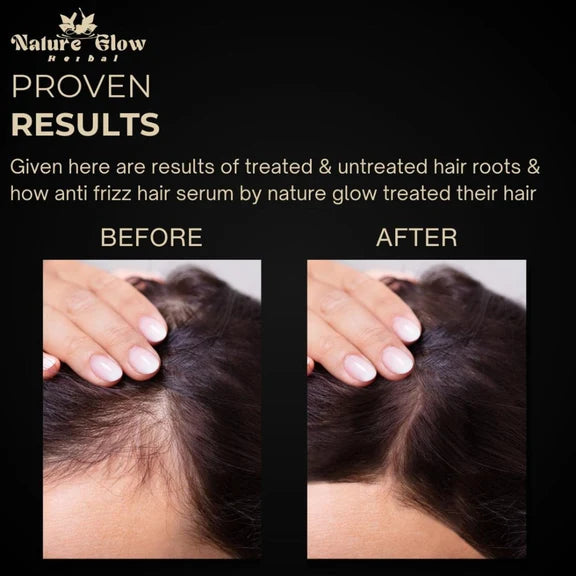 Nature Glow Herbal Anti Frizz Hair Serum - 30 ml