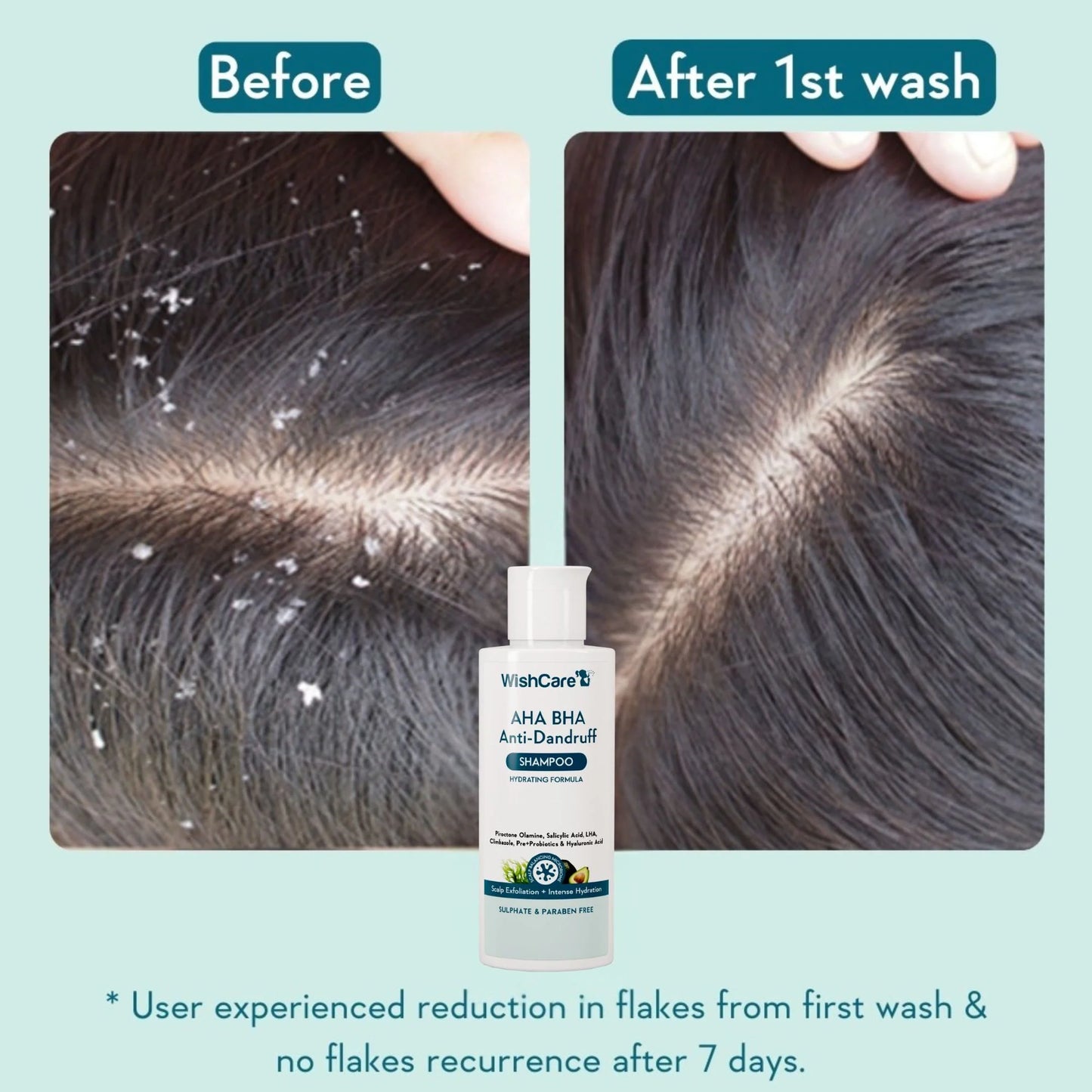 WishCare Hydrating AHA BHA Anti Dandruff Shampo-Reduces Flakes & Itchiness-100% Dandruff Reduction - 120 ml