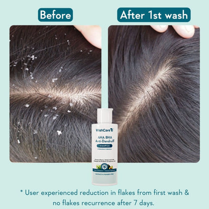 WishCare Hydrating AHA BHA Anti Dandruff Shampo-Reduces Flakes & Itchiness-100% Dandruff Reduction - 120 ml