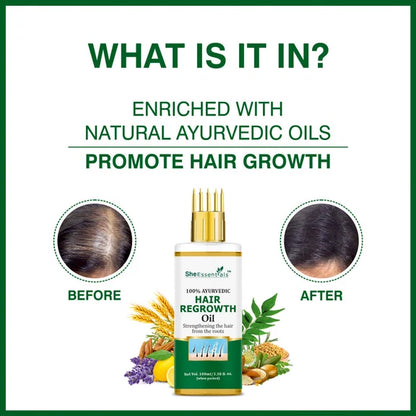 She Essentials Hair Regrowth Oil Infused With Rosemary For Anti Hair Fall & Hair Growth - 100 ml