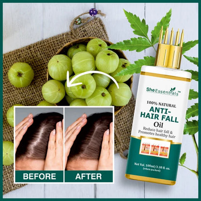 She Essentials Anti Hair Fall & Hair Growthoil For All Types Of Hair - 100 ml
