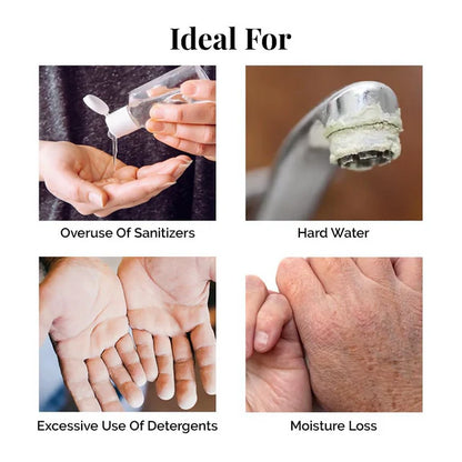 LuxaDerme Hand & Nail Rescue Cream With Shea Butter & Niacinamide - 50 ml