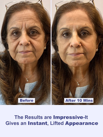 Instant Wrinkle Eraser Face Tightener