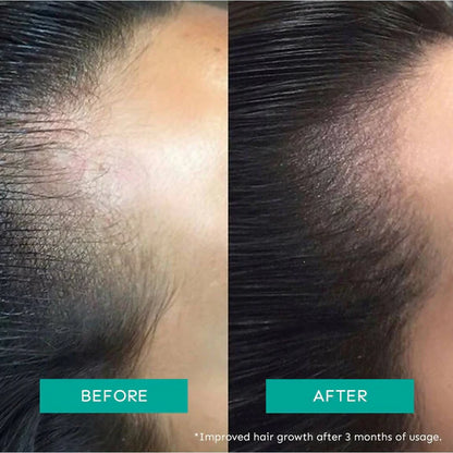 Arata Intensive Hair Growth Serum - 30 ml