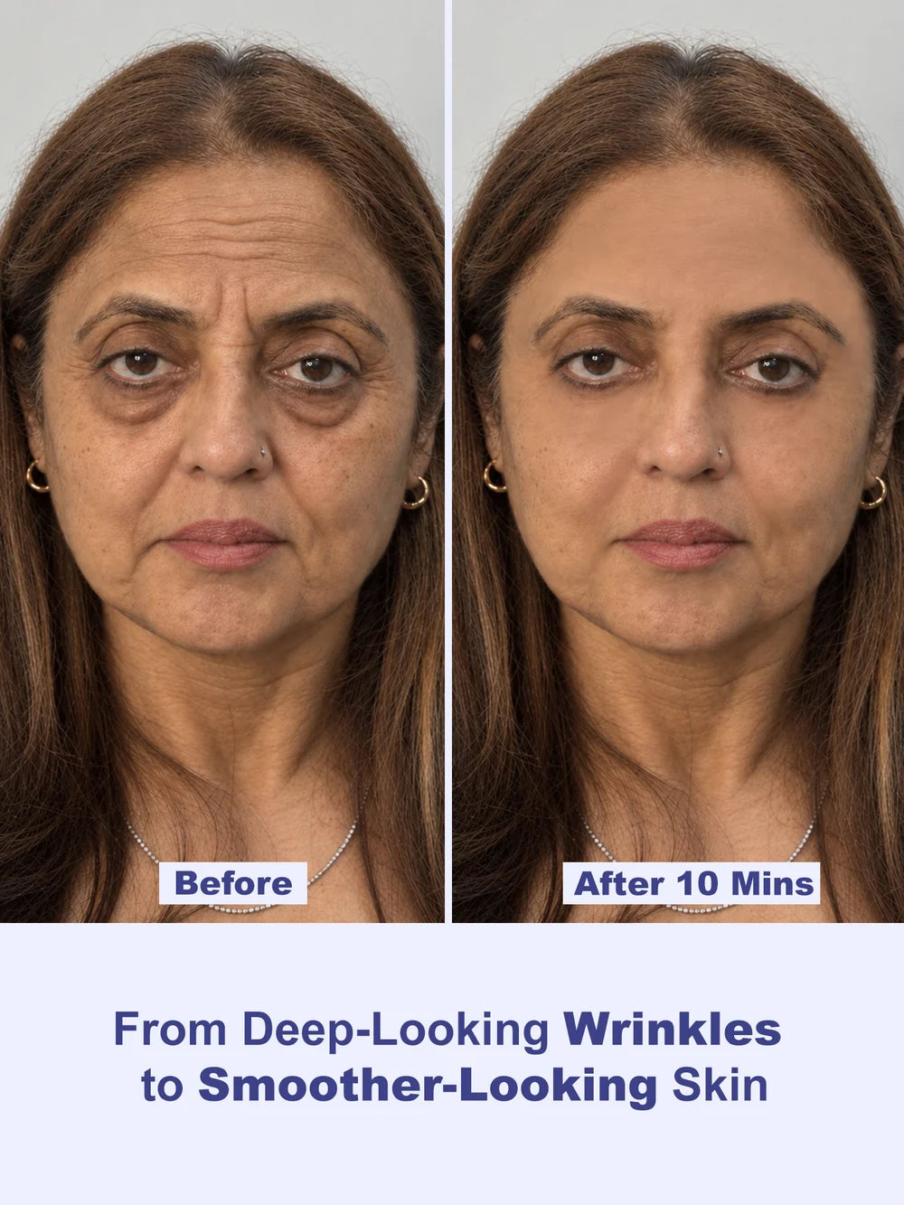 Instant Wrinkle Eraser Face Tightener