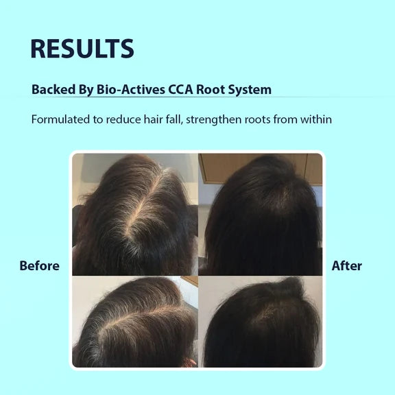 Dermistry Follicusan Hairgenyl & Caffeine Anti Hair Fall Control Serum Mask & Shampoo - combo