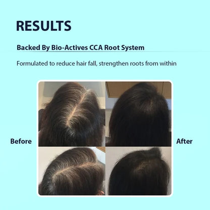 Dermistry Follicusan Hairgenyl & Caffeine Anti Hair Fall Control Serum Mask & Shampoo - combo